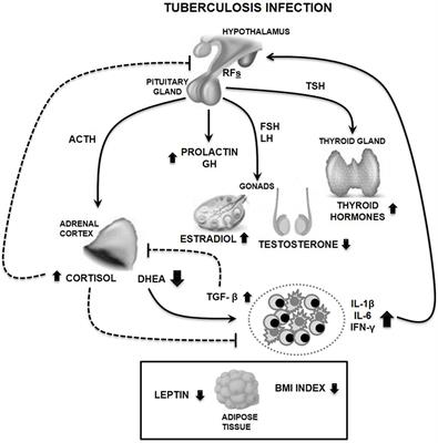 Tuberculosis, the Disrupted Immune-Endocrine Response and the Potential Thymic Repercussion As a Contributing Factor to Disease Physiopathology